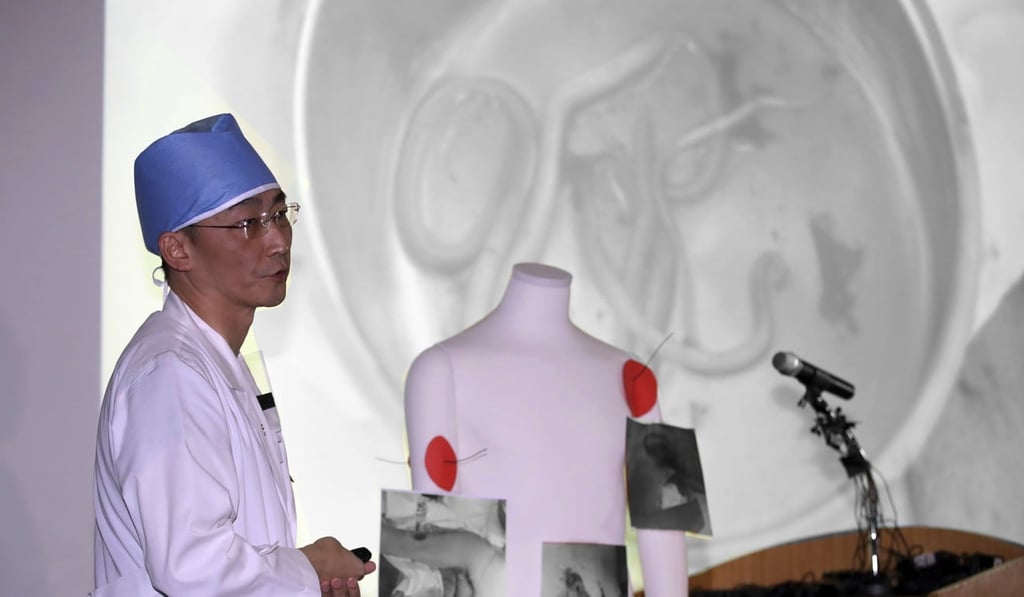 Dr Lee Cook-jong said he had never come across parasites as big as the ones he found inside the body of the North Korean soldier. Photo: AP
