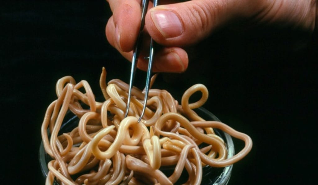 Human roundworms, seen here in a file photo, infested the digestive system of a North Korean defector, South Korean doctors say. Photo: Handout Human roundworms, seen here in a file photo, infested the digestive system of a North Korean defector, South Korean doctors say. Photo: Handout
