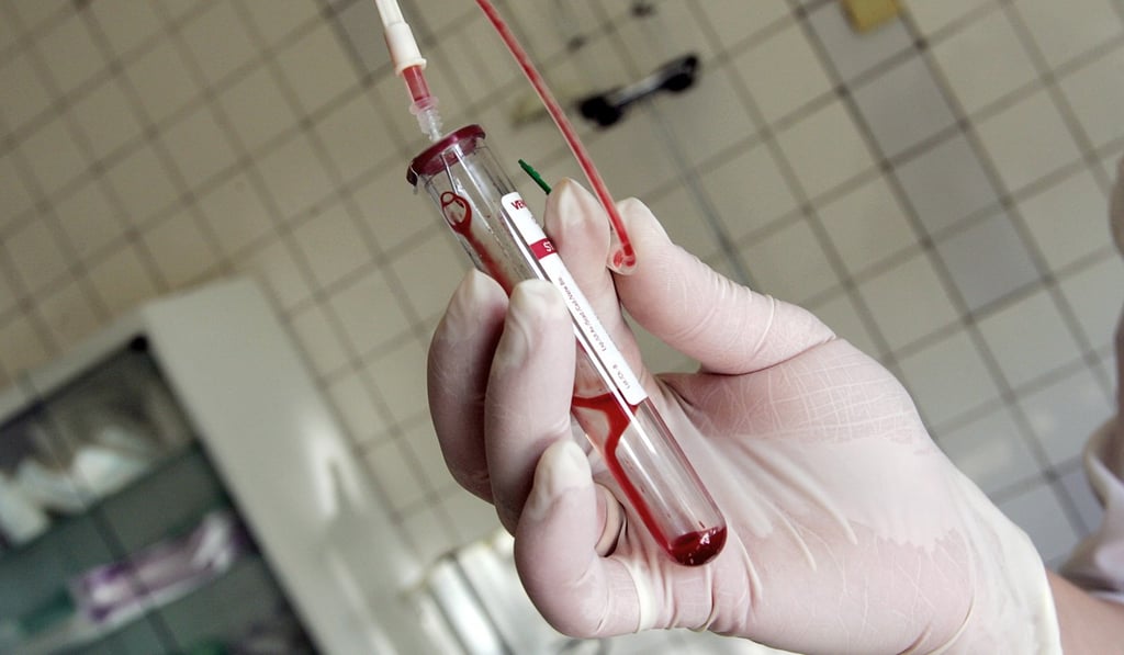 A nurse holds a test-tube with HIV-positive blood in an infectious diseases hospital in Moscow, in a file photo. Photo: Agence France-Presse A nurse holds a test-tube with HIV-positive blood in an infectious diseases hospital in Moscow, in a file photo. Photo: Agence France-Presse