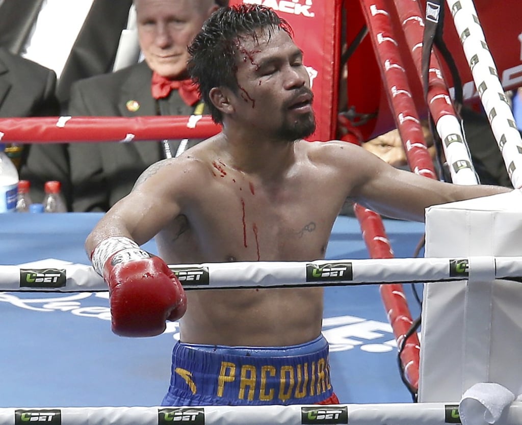 Pacquiao contemplates his defeat to Jeff Horn, of Australia, in a WBO World Welterweight title fight in Brisbane. Pacquiao has not fought since and plans for a rematch are on hold. Photo: AP