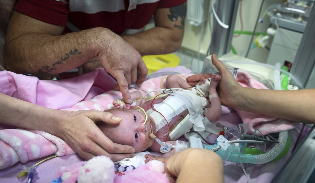 Three-week-old Vanellope Hope Wilkins at Glenfield Hospital in Leicester on Monday. Photo: AP Three-week-old Vanellope Hope Wilkins at Glenfield Hospital in Leicester on Monday. Photo: AP