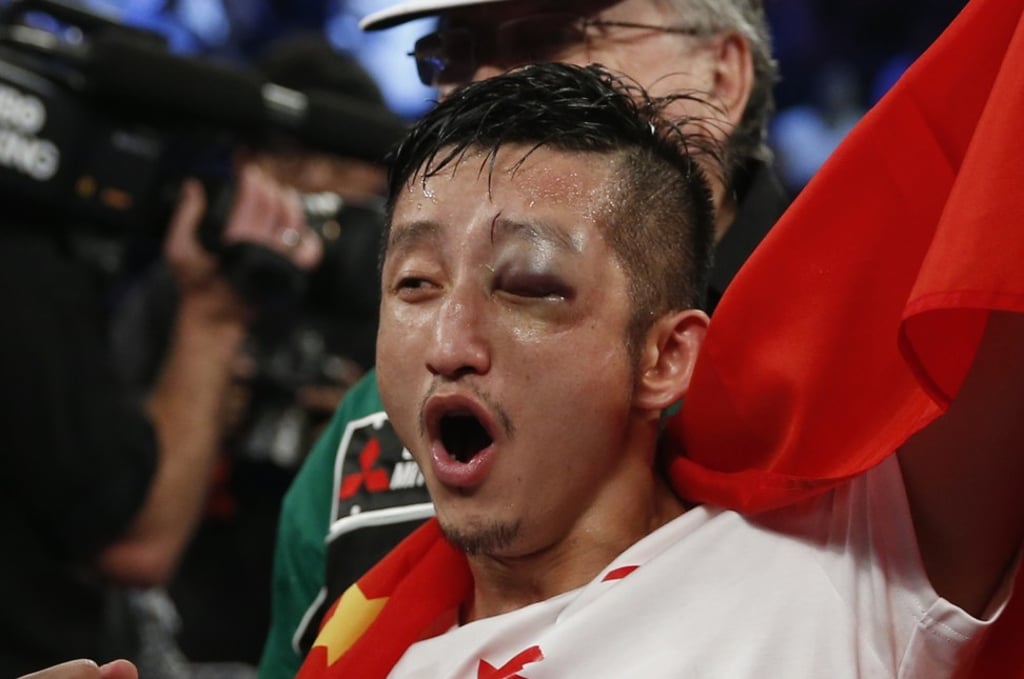 Zou Shiming sports a badly bruised left eye as he celebrates victory against Kwanpichit Onesongchaigym of Thailand during their fight in Macau in November 2014. Photo: AP