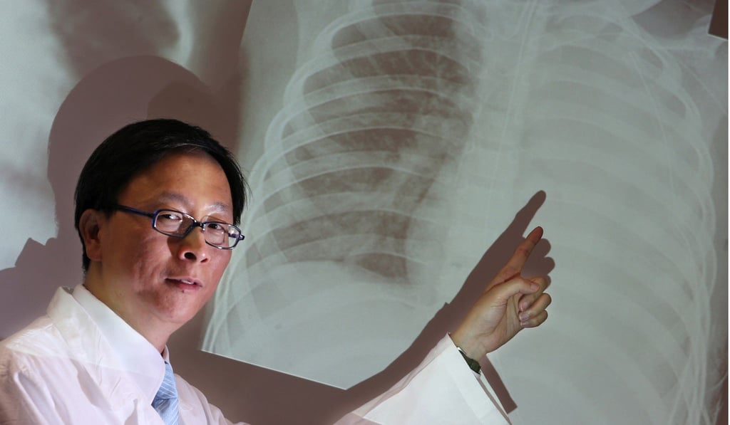 HKU microbiologist Dr Ho Pak-leung says that since the 2003 Sars outbreak public awareness of communicable illnesses has grown, but high infection rates abound due to a lack of action. Photo: Felix Wong