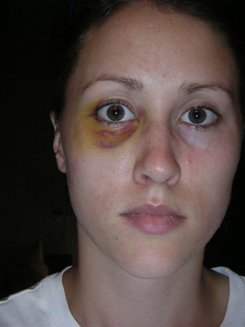 Rob Porter's ex-wife Colbie Holderness is pictured in a photo from 2005, when she says Porter gave her a black eye on a trip to Italy. Photo courtesy of Colbie Holderness