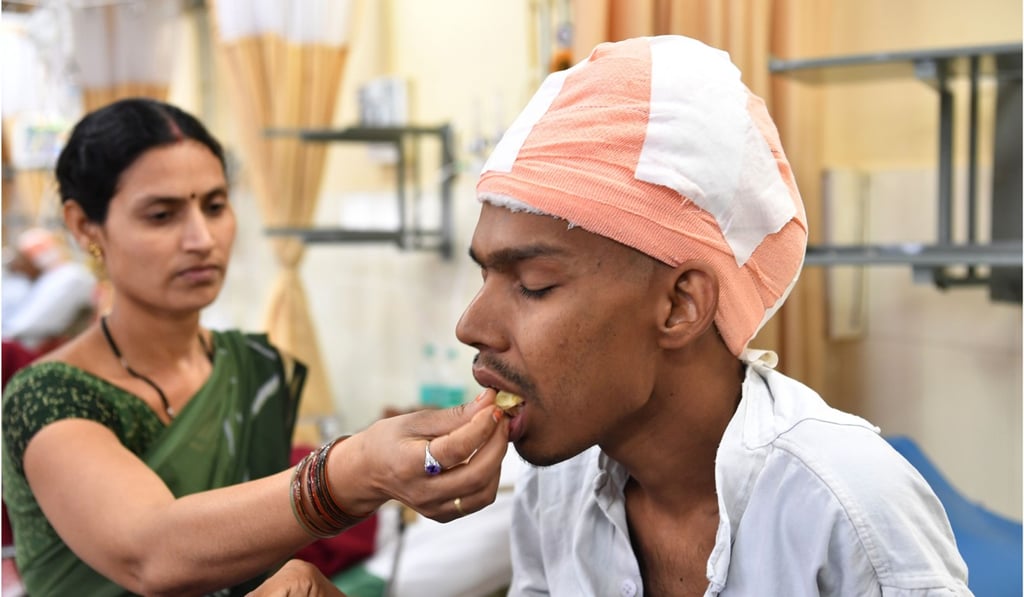 Santlal Pal, 31, rests in his bed as his wife Manju, feeds him a slice of apple at the BYL Nair hospital in Mumbai on February 22, 2018. Photo: Agence France-Presse