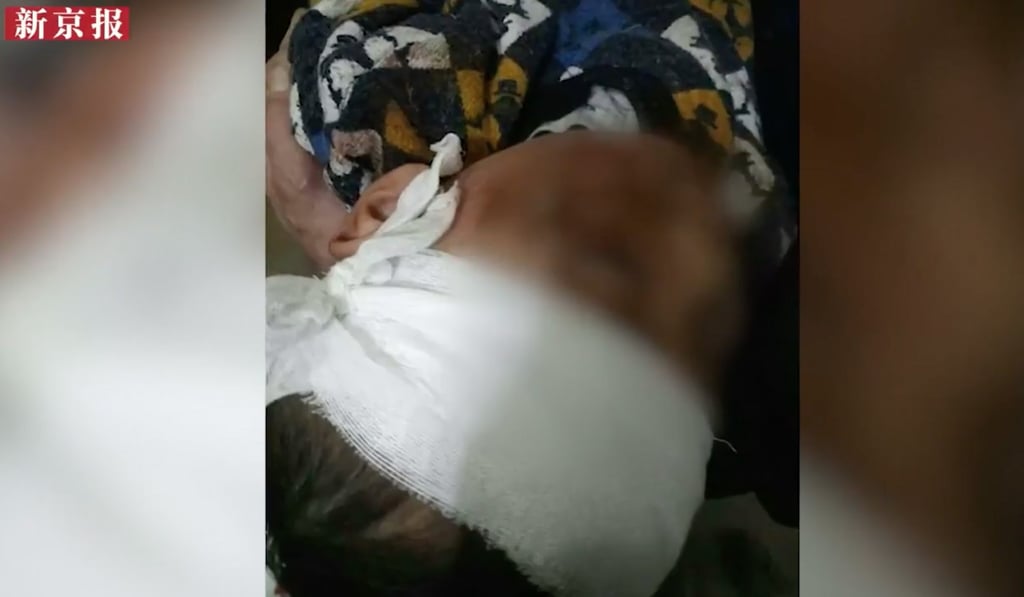 Photographs shared online showed the child had suffered a blow to his head, but doctors said his injuries were not life-threatening. Photo: YouTube Photographs shared online showed the child had suffered a blow to his head, but doctors said his injuries were not life-threatening. Photo: YouTube