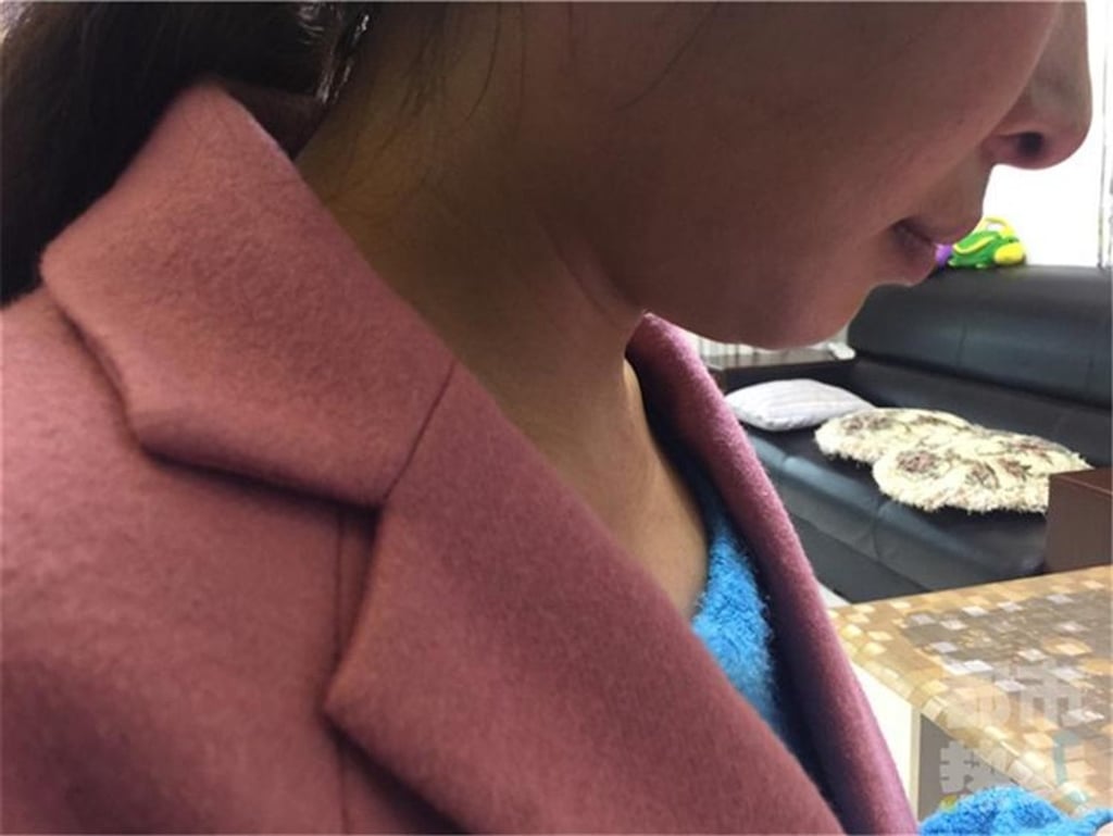 The woman said she remembered feeling someone grabbing at her neck and hair. Photo: Chinanews.com