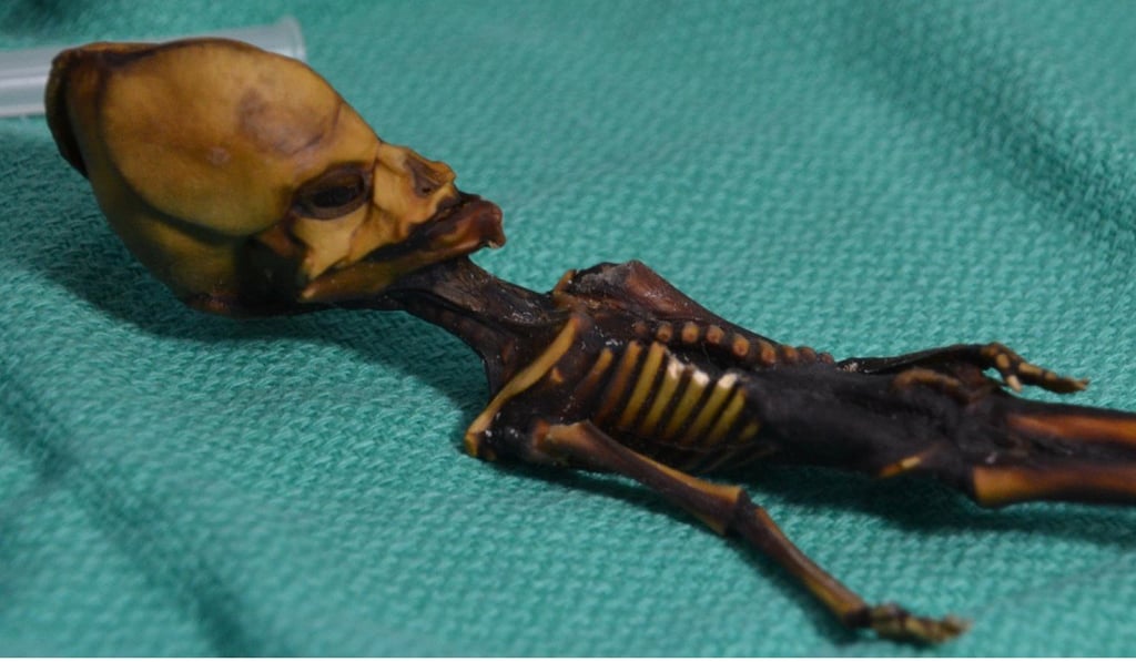 A closer look at the Atacama skeleton, or Ata, named after the Chilean desert where the remains were found, reveals 10 pairs of ribs, instead of the normal 12. Photo: Bhattacharya et al. A closer look at the Atacama skeleton, or Ata, named after the Chilean desert where the remains were found, reveals 10 pairs of ribs, instead of the normal 12. Photo: Bhattacharya et al.