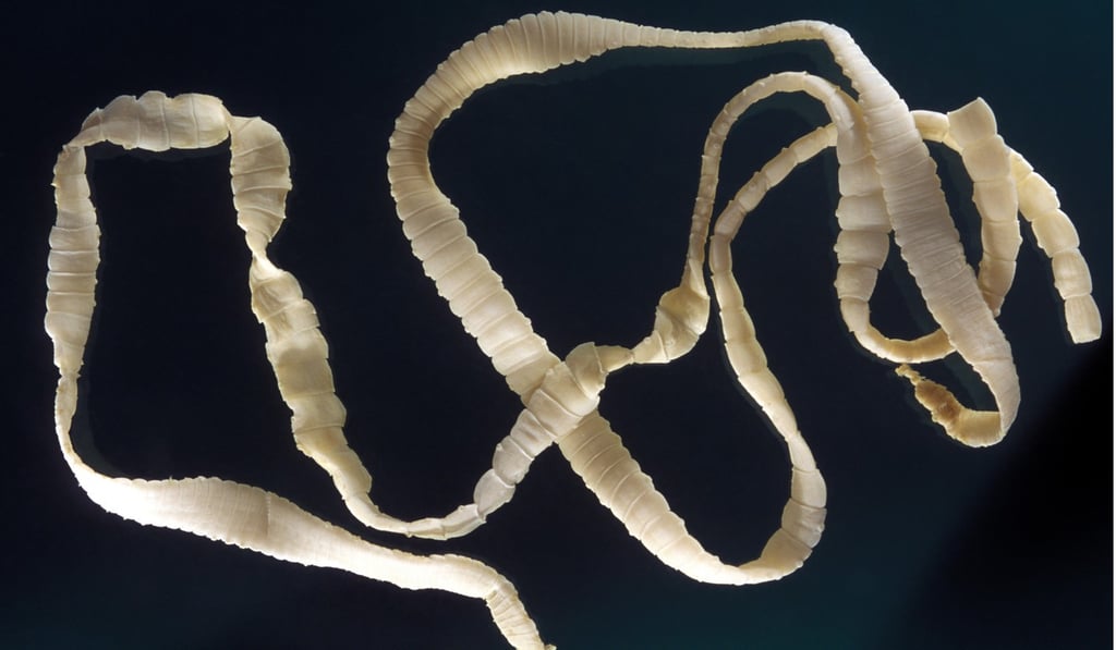 A tapeworm that can infect a human body. Photo: Alamy