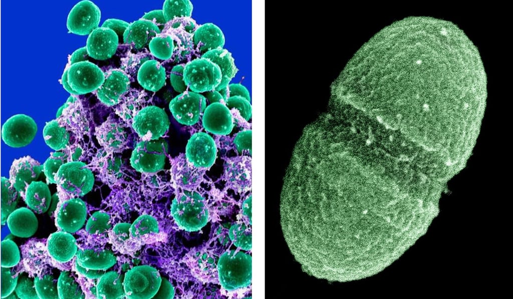 The Staphylococcus (left) and Enterococcus superbugs. Photos: AP
