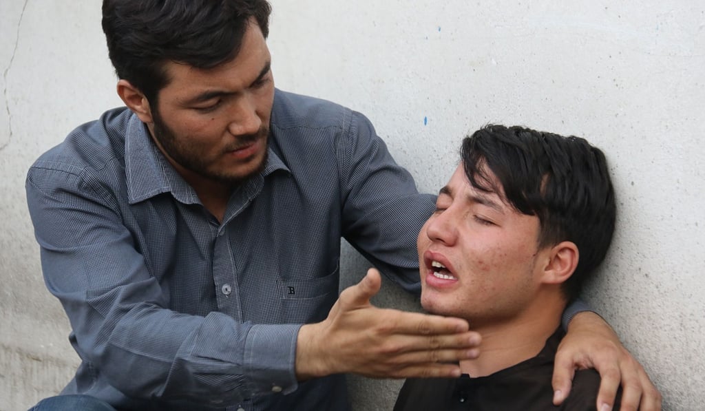 An Afghan resident weep for his relative following a suicide attack in Kabul on Wednesday. Photo: Agence France-Presse An Afghan resident weep for his relative following a suicide attack in Kabul on Wednesday. Photo: Agence France-Presse