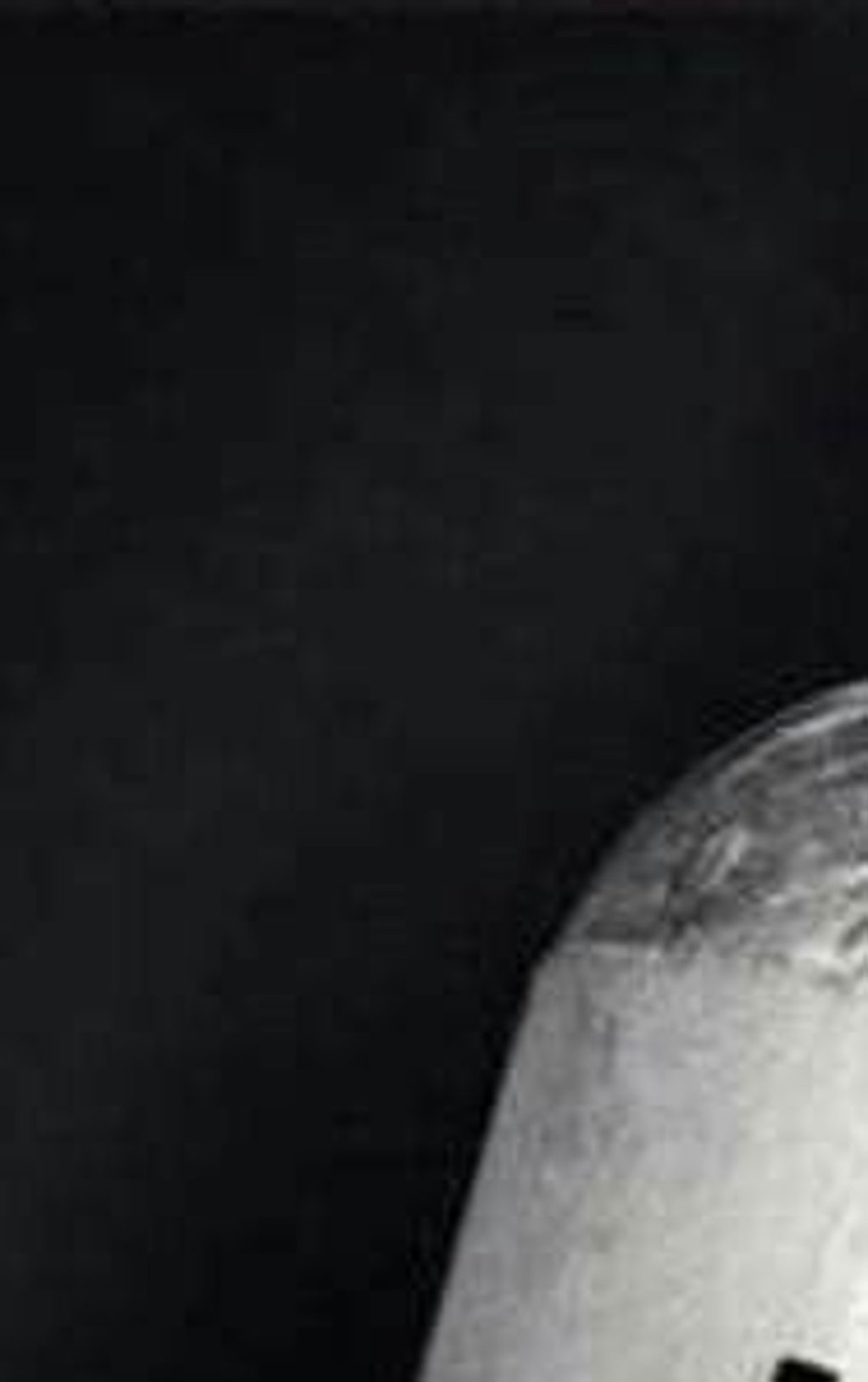 Taking LSD can improve the well-being of some hospital patients, recent studies show