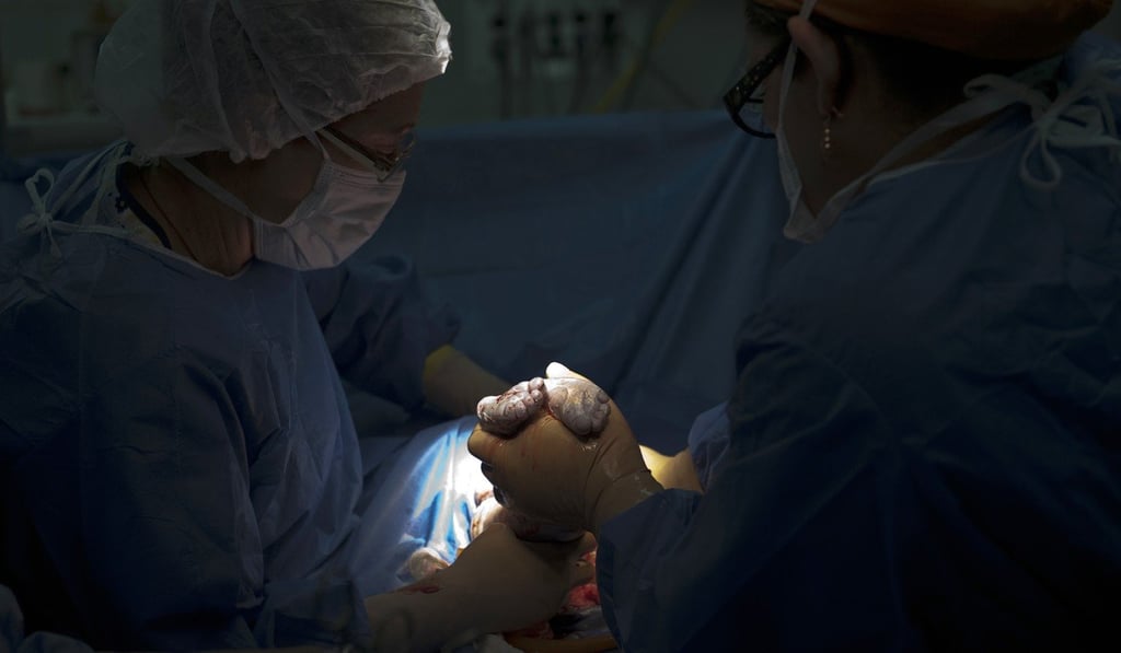 Gynaecologists warn of an ’epidemic’ of caesarean sections. Photo: AFP