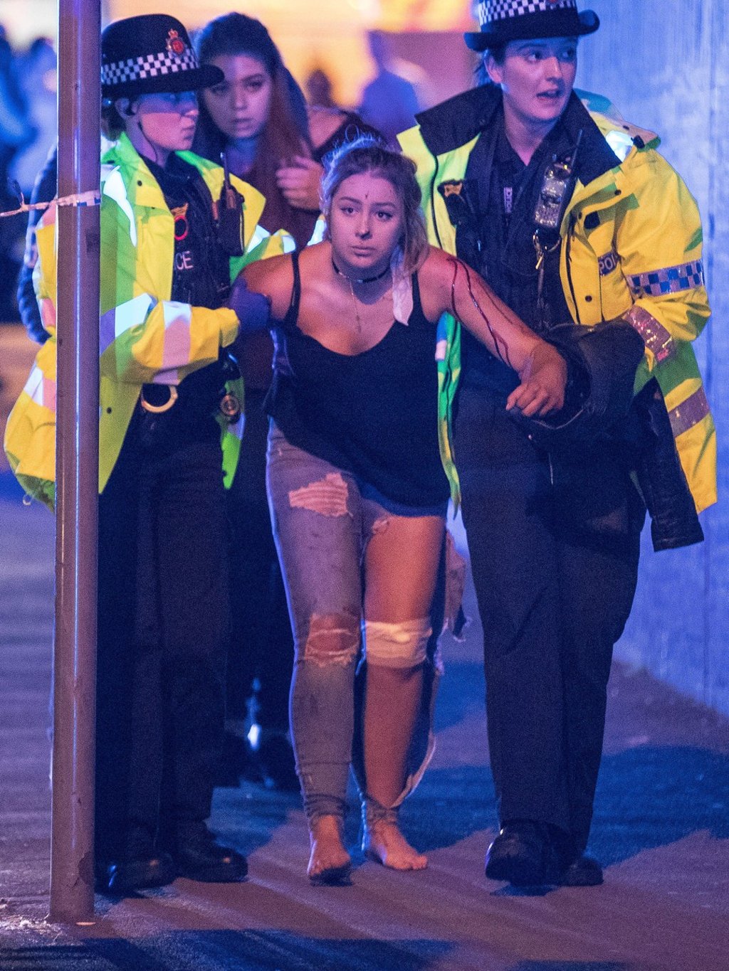 An injured concertgoer is helped by police and emergency responders after the May 22, 2017 bomb attack at the Manchester Arena. Photo: TNS