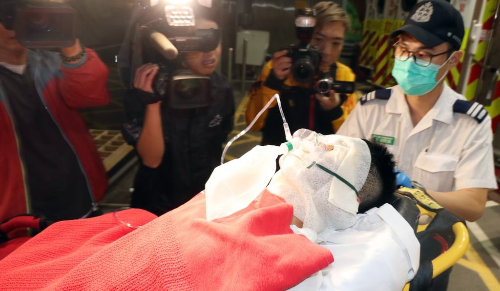 A 21-year-old female student surnamed Chan was in a serious condition at Queen Elizabeth Hospital with injuries to her hands, feet and face. Photo: SCMP Pictures