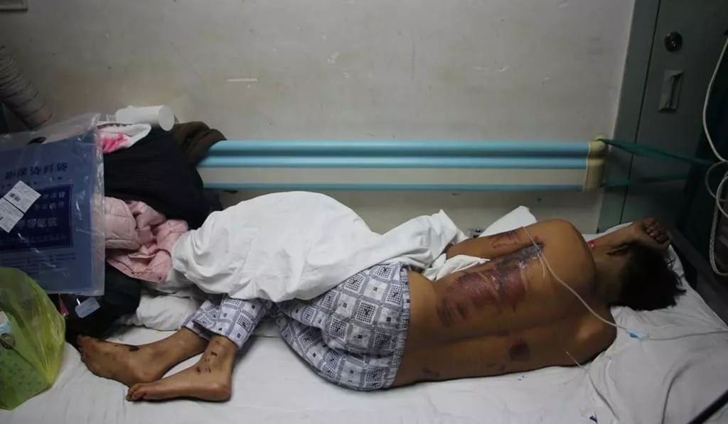 The bridegroom recovers in hospital after being hit by a car while escaping his friends’ mistreatment as part of China’s notorious wedding hazing ritual. Photo: Sohu The bridegroom recovers in hospital after being hit by a car while escaping his friends’ mistreatment as part of China’s notorious wedding hazing ritual. Photo: Sohu