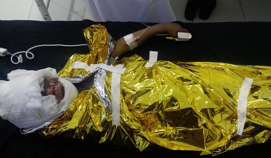 An Afghan boy receives treatment at a hospital after an air strike in Helmand province. Photo: Reuters