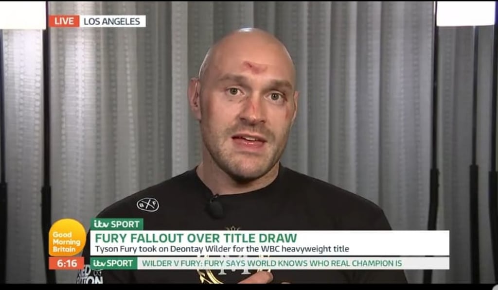 Tyson Fury appears on Good Morning Britain. Photo: Handout Tyson Fury appears on Good Morning Britain. Photo: Handout