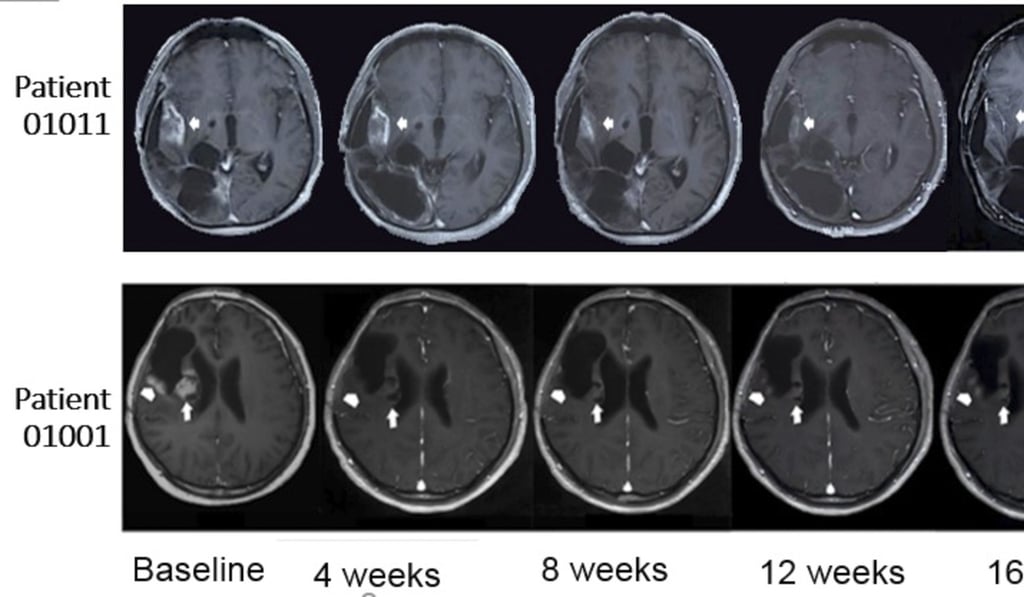 Two patients experienced significant tumour shrinkage lasting more than 12 weeks in the clinical trial. Photo: Hong Kong University of Science and Technology