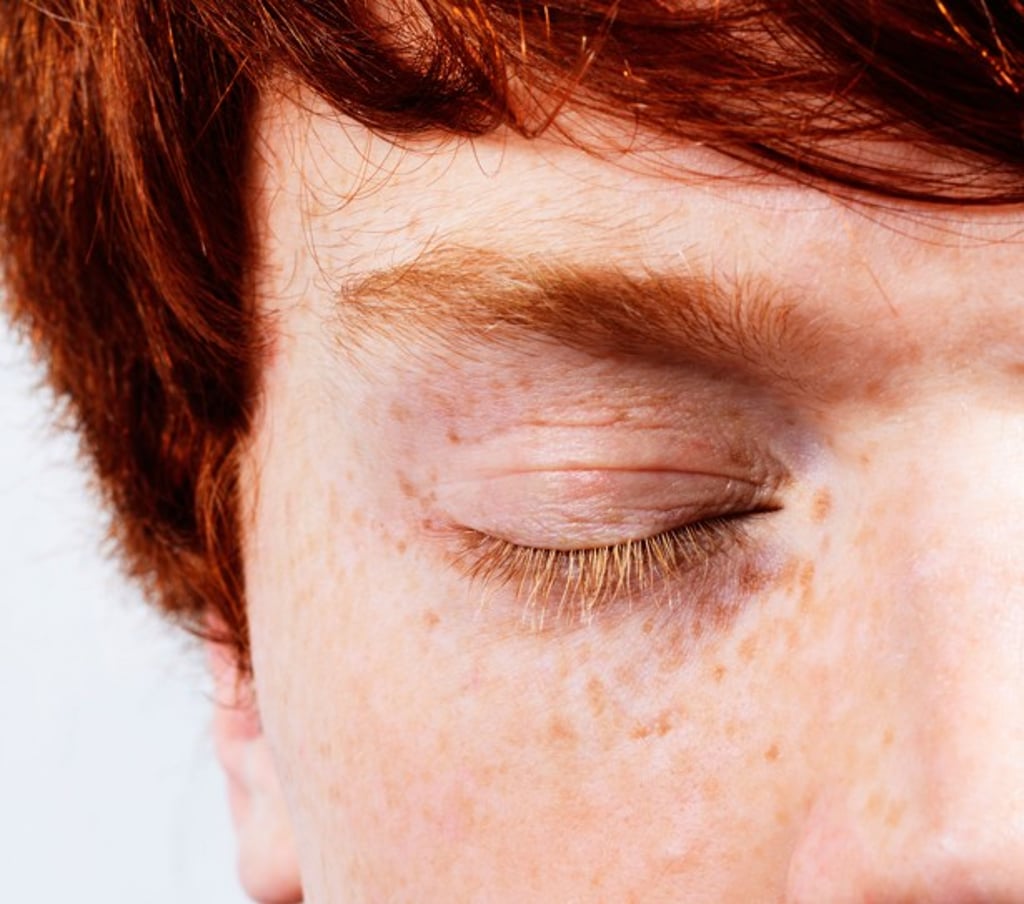 Pheomelanin is a type of melanin that causes a yellow to red colour in skin. Photo: Alamy