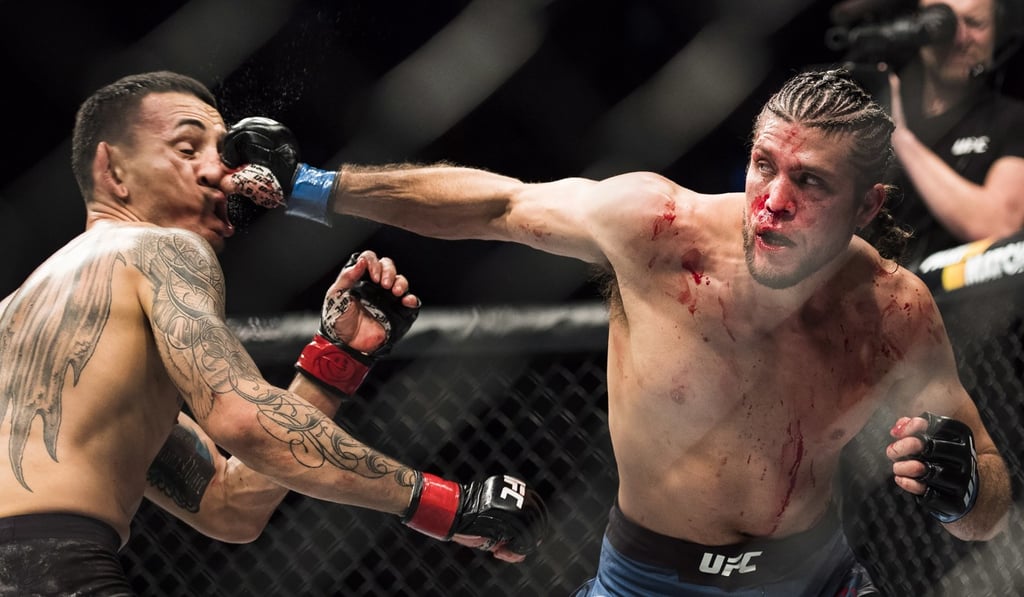 Max Holloway take a punch to the face from Brian Ortega. Photo: AP