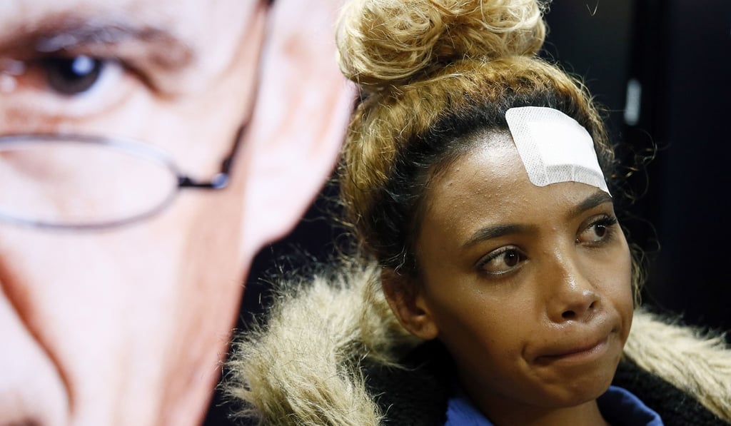 South African model Gabriella Engels, allegedly assaulted by Grace Mugabe, looks on during a press conference at the civil rights organisation AfriForum on August 17, 2017. Photo: AFP