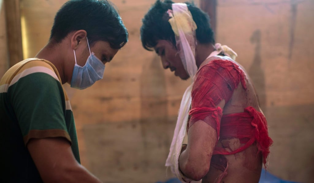 A file photo o f a local doctor working for the Kachin Independence Army ethnic group attending to a KIA rebel with shrapnel wounds. Photo: AFP