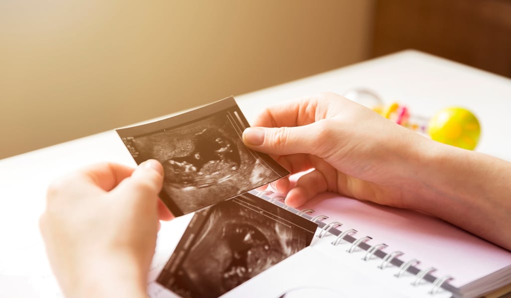 Jennifer Purdie’s new boyfriend gave her a sonogram of the child he was going to have with his ex-girlfriend as a present. Photo: Shutterstock Jennifer Purdie’s new boyfriend gave her a sonogram of the child he was going to have with his ex-girlfriend as a present. Photo: Shutterstock