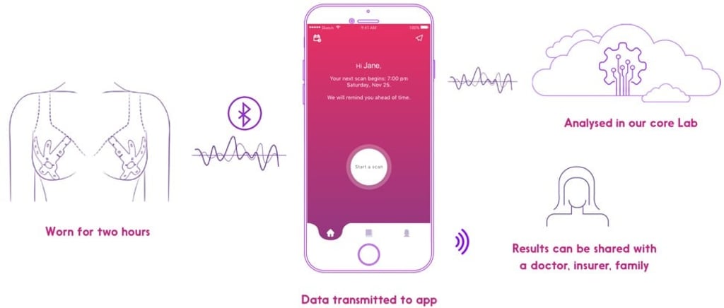 A diagram of the workflow for the iTBra sensor. The insert detects early signs of breast cancer. Photo: Crycadia Asia A diagram of the workflow for the iTBra sensor. The insert detects early signs of breast cancer. Photo: Crycadia Asia