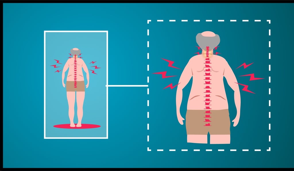 Spondylosis occurs when discs have lost so much fluid, they crack and flake away. This condition is generally due to ageing but can be accelerated by bad habits. Graphic: SCMP