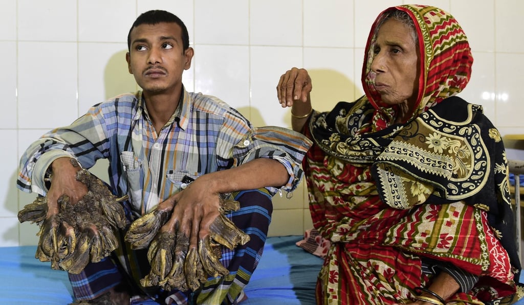 Abul Bajandar. Photo: AFP