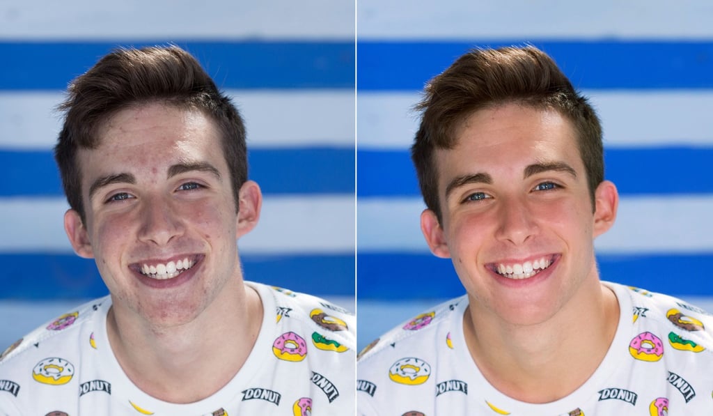 Unrealistic selfie images cause some to seek cosmetic surgery. Photo: FaceTune