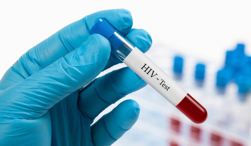 Testing positive for HIV presents barriers to staying in some countries. Photo: Alamy