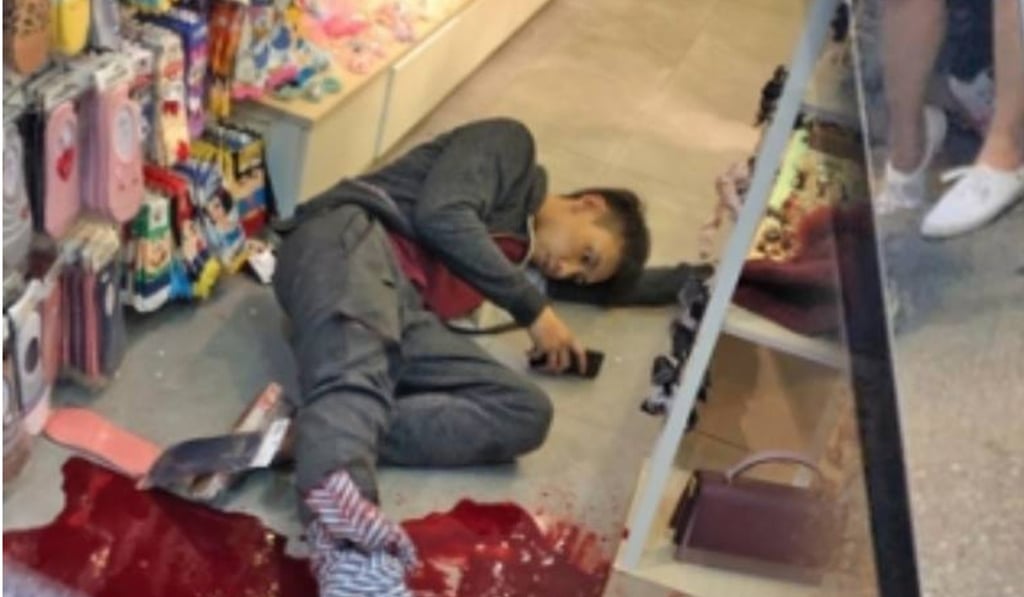 Ronald Wong sustained a leg injury after being attacked by a gang of five. Photo: Facebook