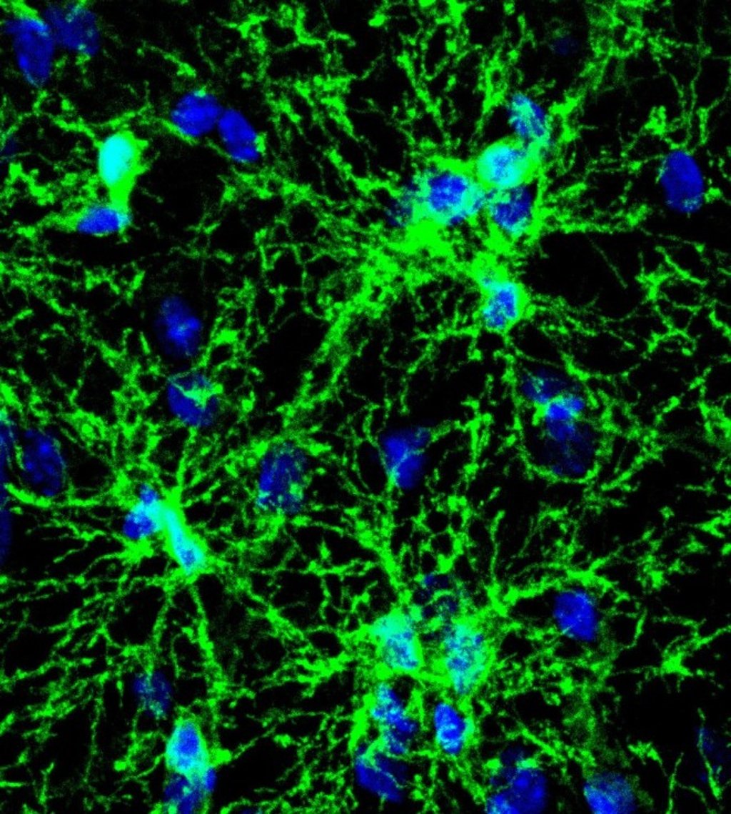 Astrocytes Astrocytes