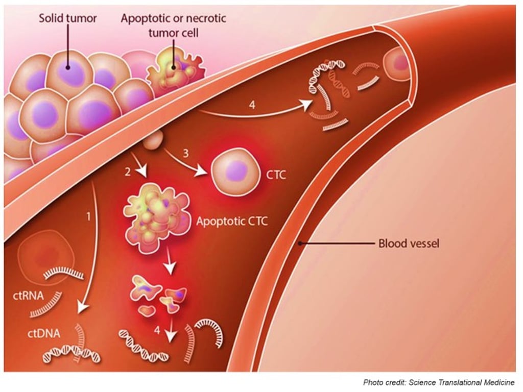 The new technology developed by CityU’s research team can detect circulating tumour cells (CTC) in blood. Tumours as small as 0.1mm in the early stages of cancer can be detected.  (Photo credit: Science Translational Medicine)