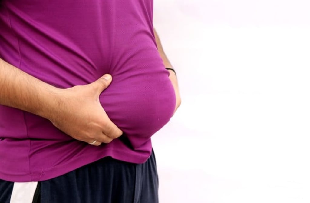 Obesity is a major risk factor for many chronic diseases Obesity is a major risk factor for many chronic diseases