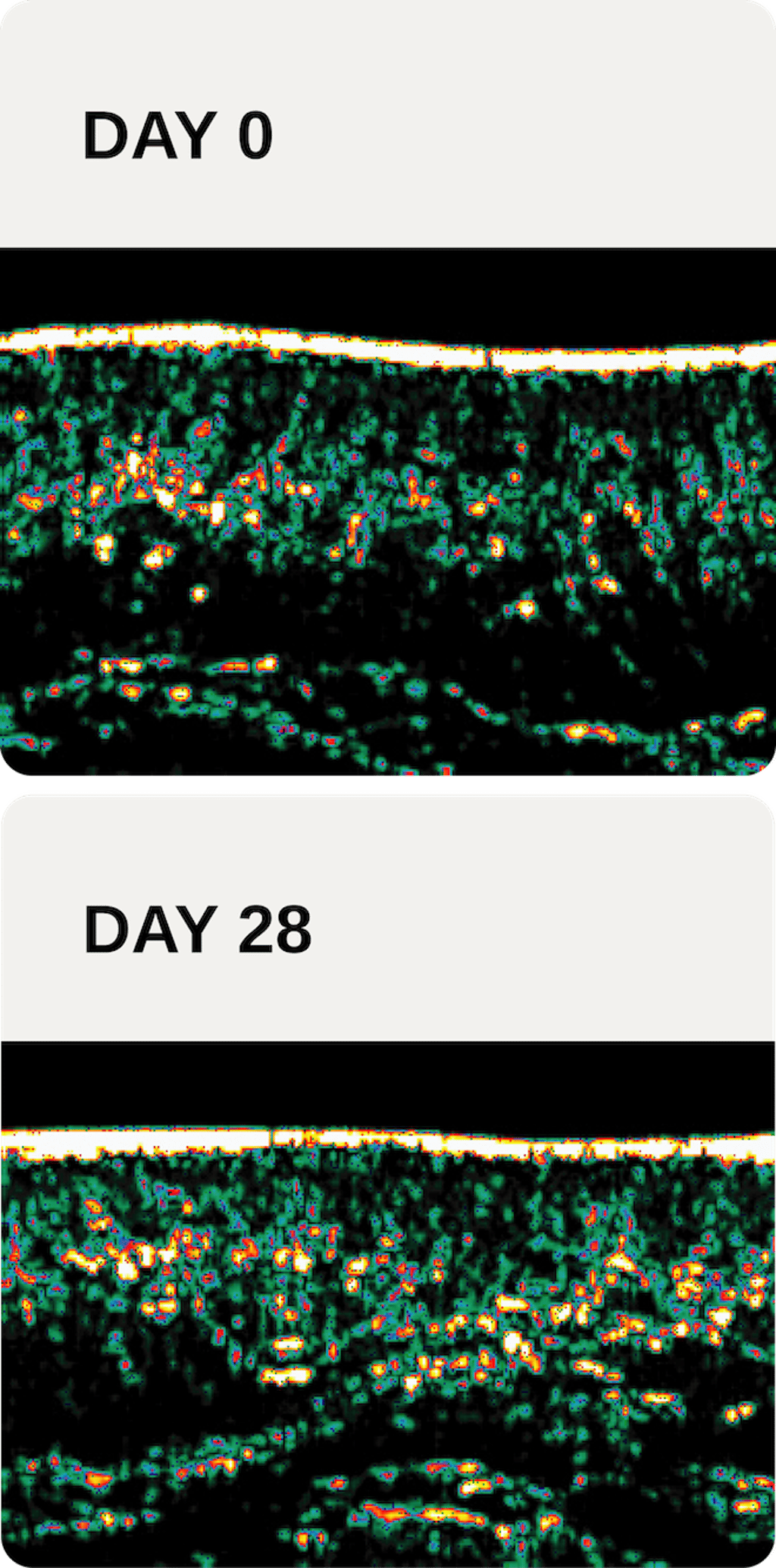 Ultrasound cross-sections of the skin at Day 0 (top) and Day 28 (bottom) demonstrate increased dermal density and improved structural integrity after four weeks of using a cream containing ZelluGEN™ as the sole active ingredient.