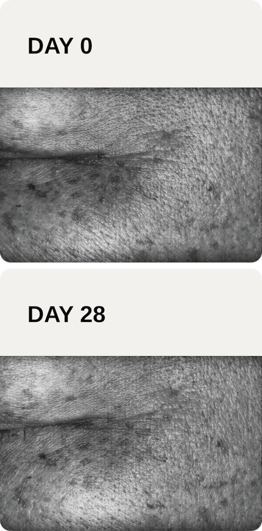 Close-up images of the eye contour area at Day 0 (top) and Day 28 (bottom) demonstrate lightened lines and improved skin texture after four weeks of using a cream containing ZelluGEN™ as the sole active ingredient.