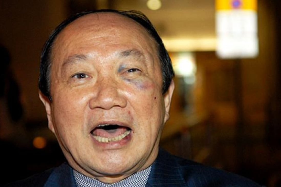 The assault left former legislator Chim Pui-chung with a swollen face and a few minor injuries. Photo: SCMP Pictures