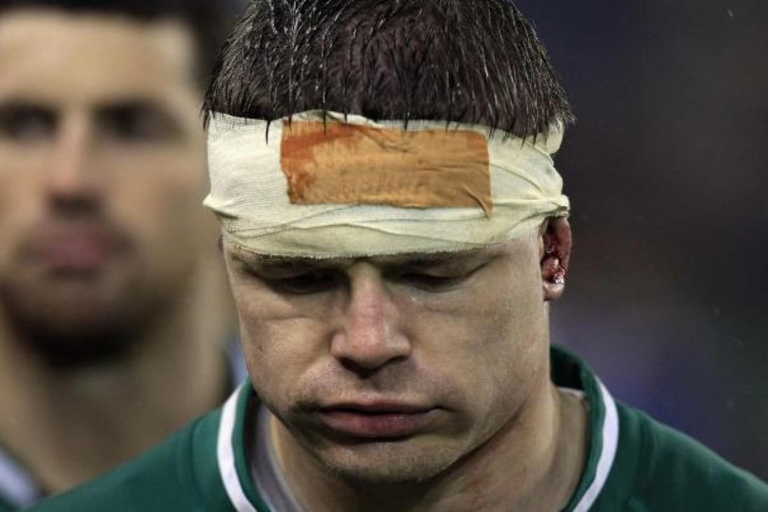 Ireland's Brian O'Driscoll after drawing with France. Photo: Reuters