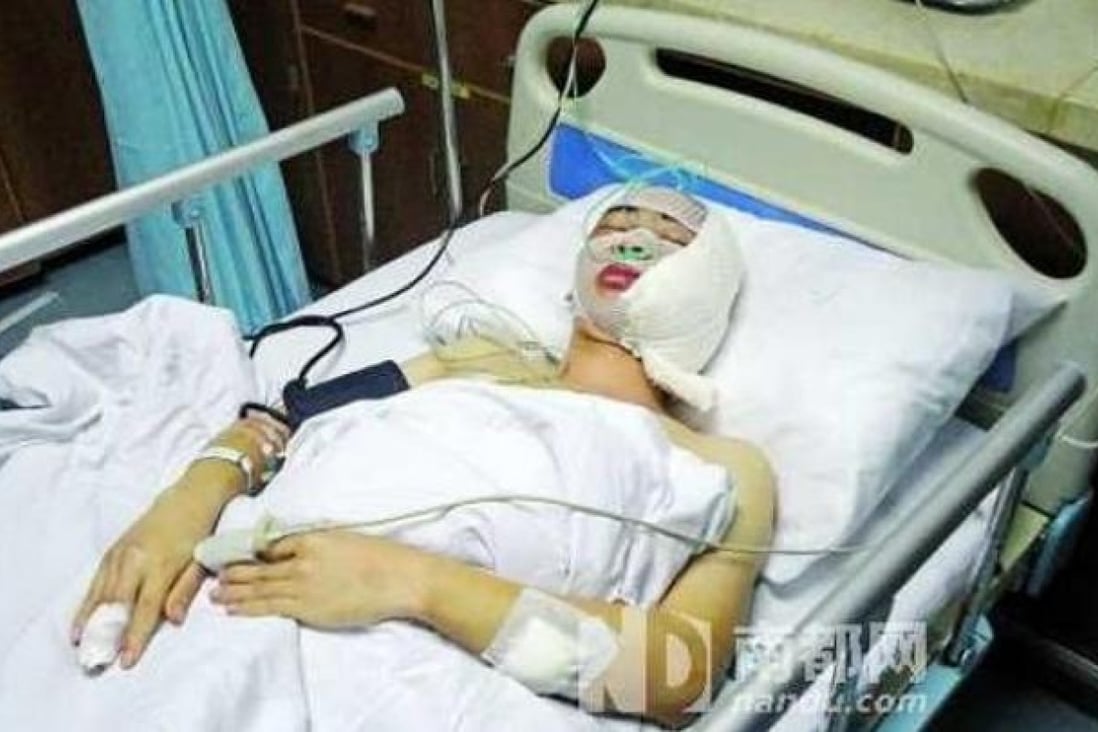 Photo from nandu.com, of the injured chengguan official in hospital. 