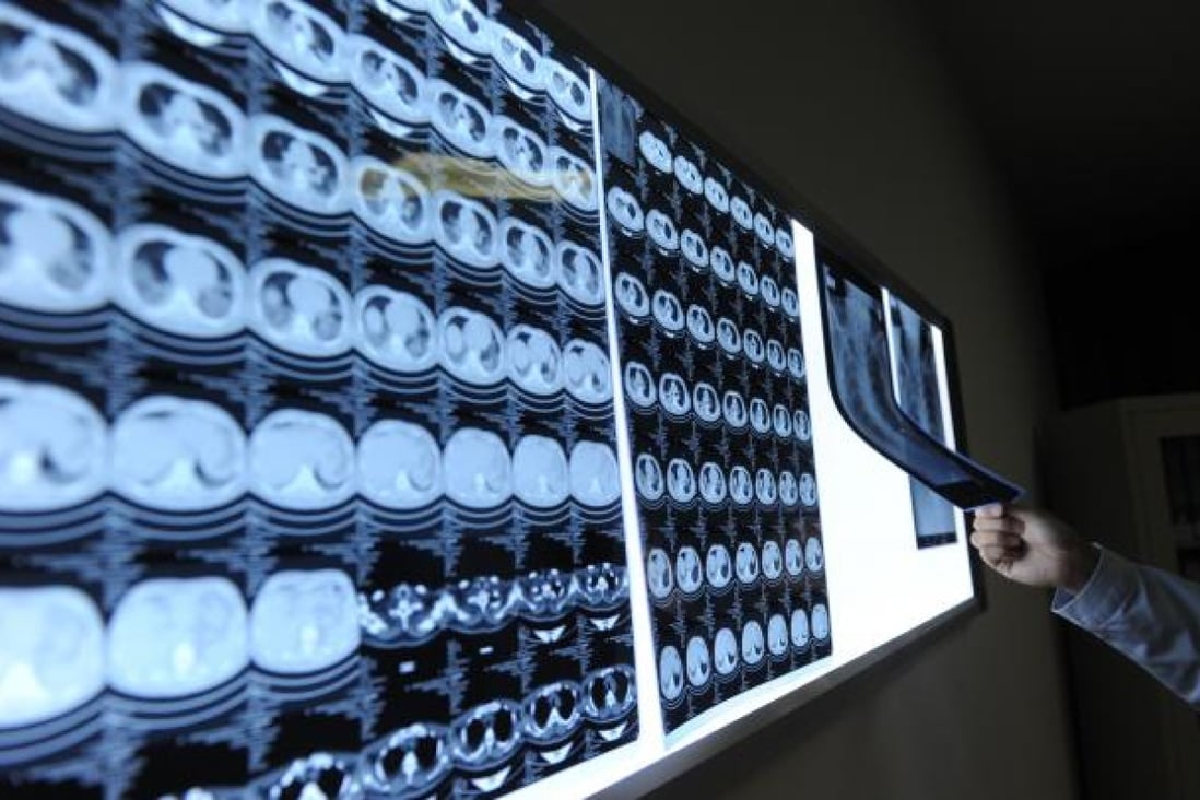 A doctor looks at lung CT images and chest films of a man infected with H7N9. The new bird flu could be mutating up to eight times faster than an average flu virus. Photo: Xinhua