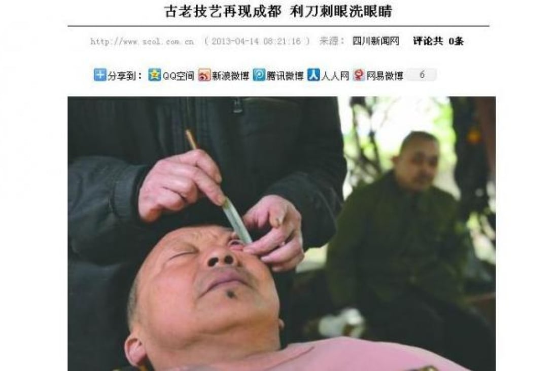 Liu Deyuan conducts 'eye shaving' on one of his customers. 