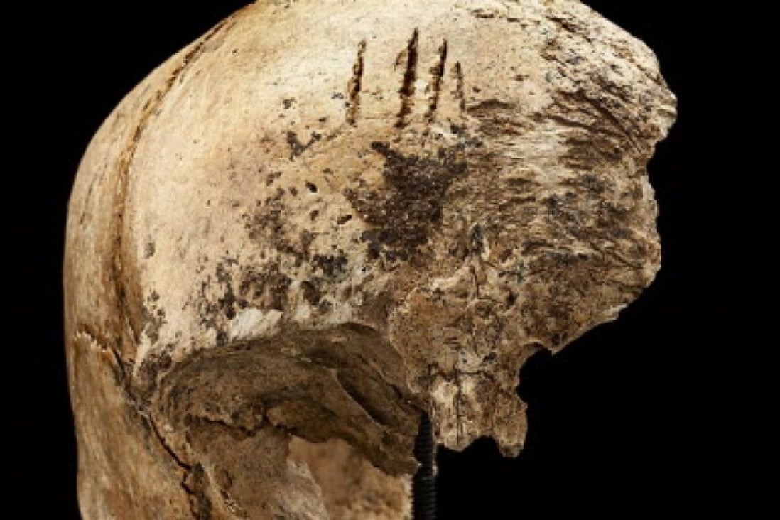 Four shallow chops to an incomplete skull excavated in James Fort, Jamestown, Virginia at the Jamestown Rediscovery Project. Photo: Reuters