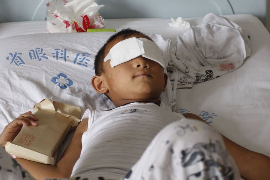 Boy's eyes gouged out by his aunt, police say South China Morning Post