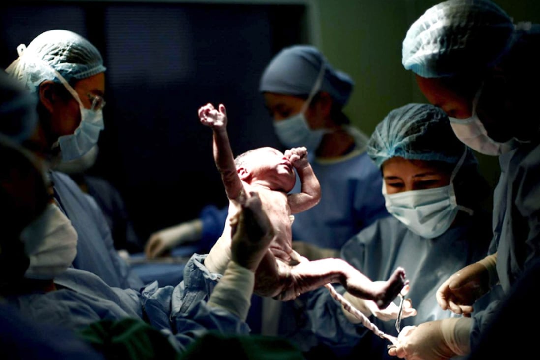 A doctor holds up the baby of a 26-year-old mother as she undergoes a caesarian section at Ruijin Hospital in Shanghai. Photo: Reuters