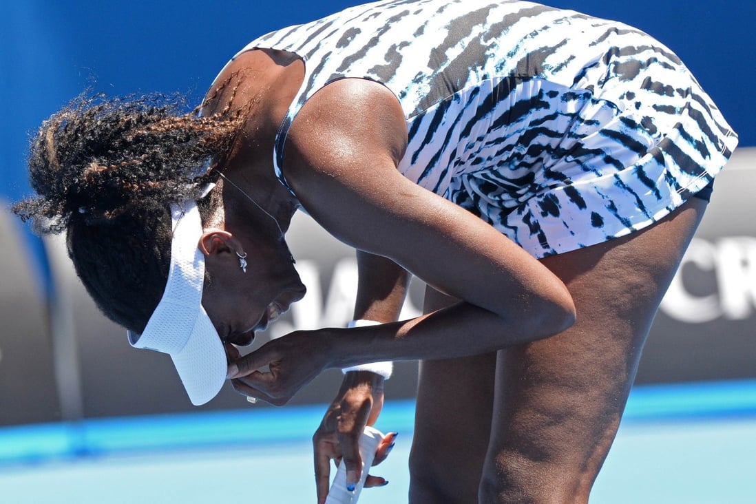 Venus Williams reacts to losing another point in her defeat by   Russia's Ekaterina Makarova. Photo: AFP