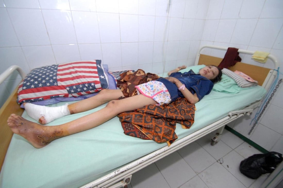 Erwiana Sulistyaningsih in hospital in Sragen, Java. Police plan to go there in the next few days to take a statement. Photo: AFP