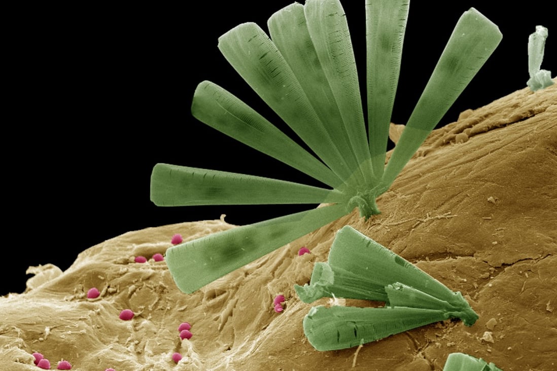 Microscopic diatoms with taste for marine refuse could help clean up